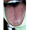 [A:F44B]tongued[A:F7CE]舌[A:F44B]